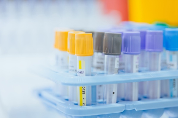 Professionnels de sant� : du nouveau pour les examens biologiques 